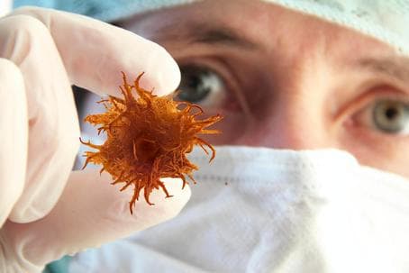 Онкологические заболевания