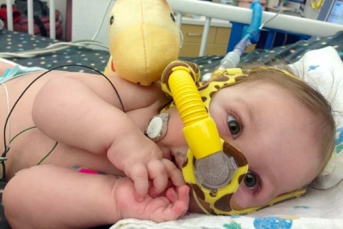 Спинальна мышечная атрофия